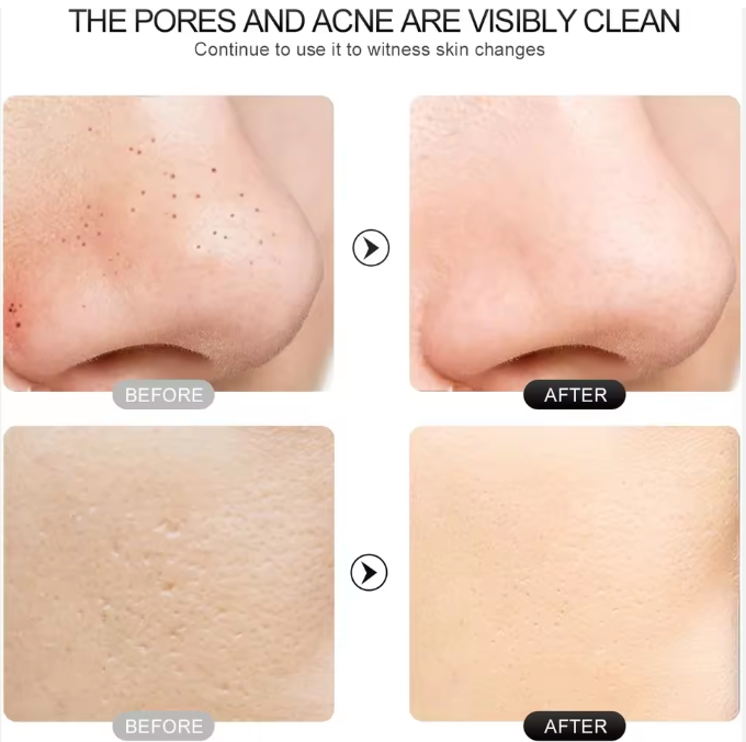 Spatule électrique pour le visage !