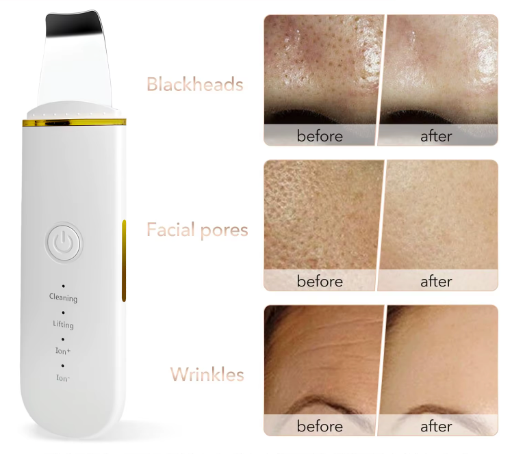 Spatule électrique pour le visage !