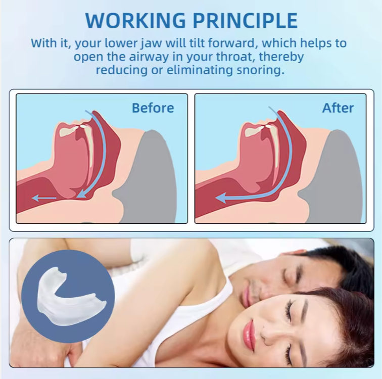 Embouchure anti-ronflement réglable pour une meilleure qualité de sommeil la nuit !